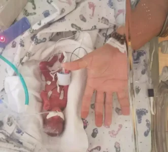 Miracle : un bébé combatif naît à 23 semaines de grossesse