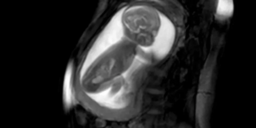 Ces nouvelles images du bébé dans l'utérus pourraient sauver des milliers de nouveau-nés