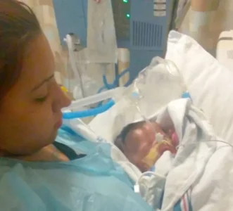 Un bébé texan naît sans peau et lutte pour sa survie